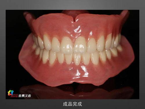 国产假牙套生产视频,匠心独运，品质卓越